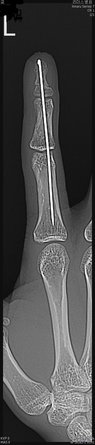 28c9b2aead27b2c8fe9419e1c31c66a4_1515565