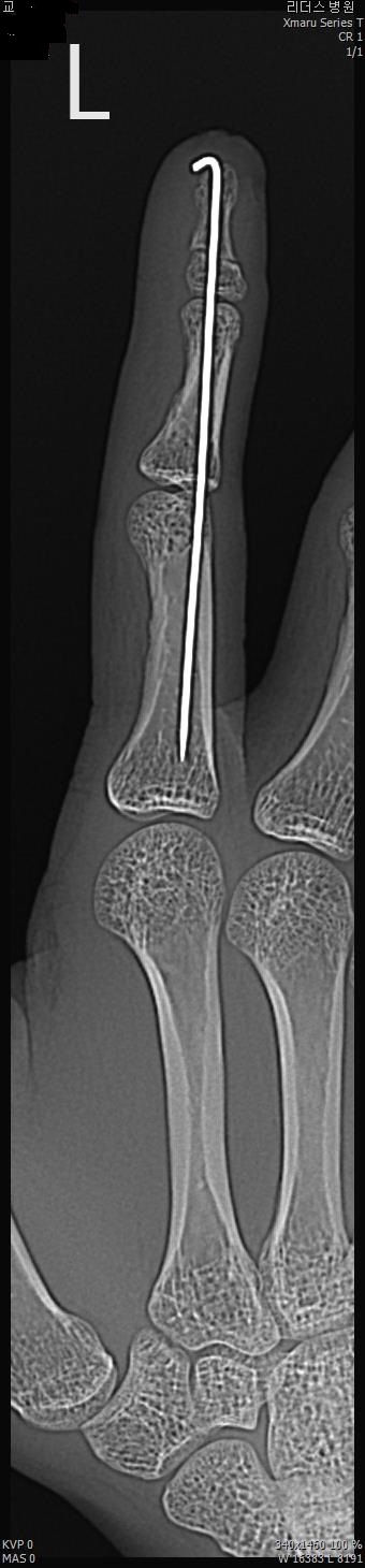 28c9b2aead27b2c8fe9419e1c31c66a4_1515565