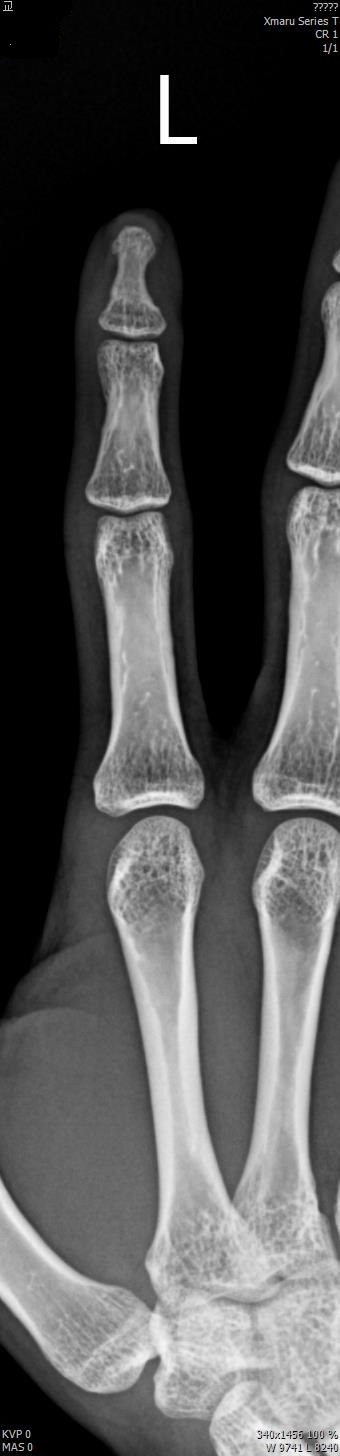 28c9b2aead27b2c8fe9419e1c31c66a4_1515565