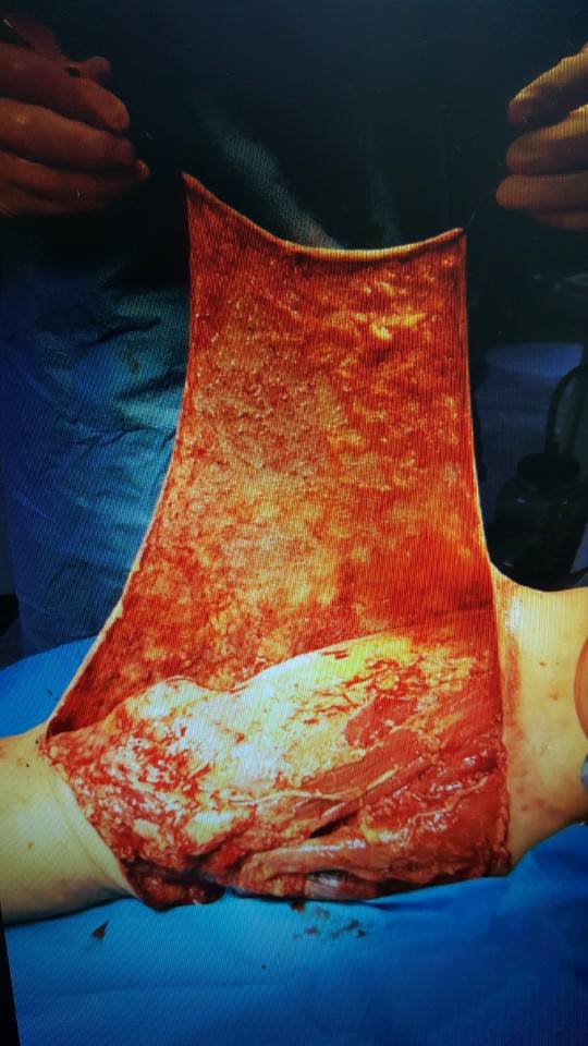 99c8ab691b21626a411d7fcb55b0e121_1515745074_49.jpg 99c8ab691b21626a411d7fcb55b0e121_1515745